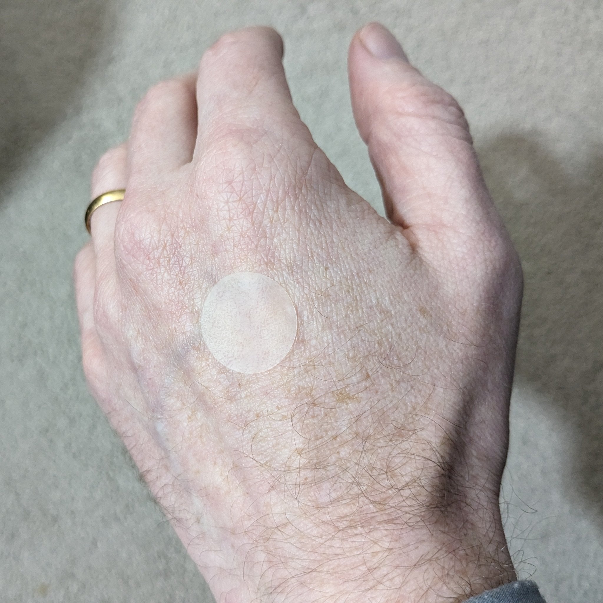 Envirobug Itch Relief Patches (for insect bites) 40 Pack-Envirobug